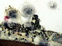 Black mold on a wall
